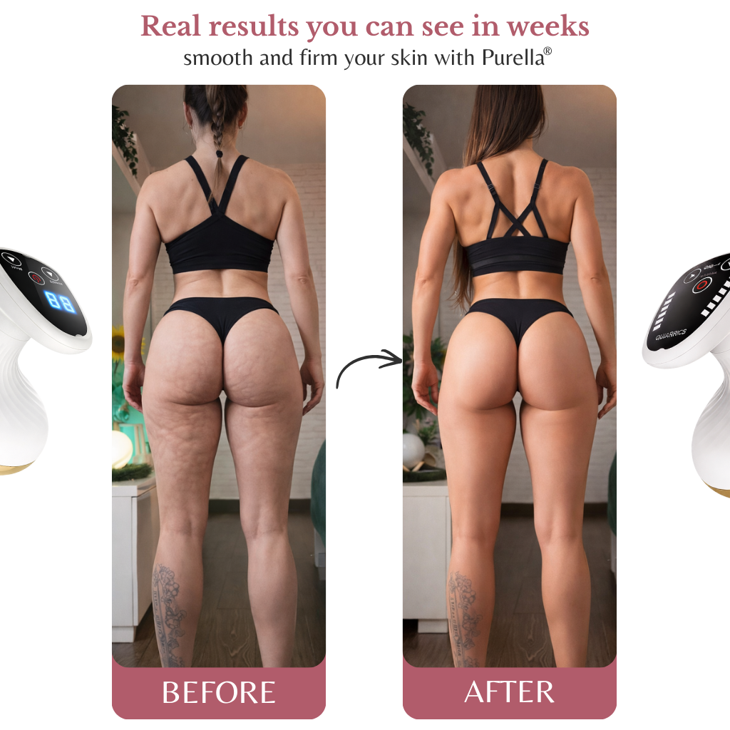 PURELLA® Electric Cupping Messager – Anti-Cellulite.